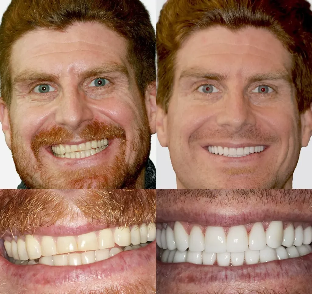 patrick_ (1)